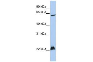 MGRN1 antibody used at 1 ug/ml to detect target protein. (Mahogunin RING Finger Protein 1 antibody  (Middle Region))