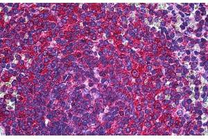 Human Spleen: Formalin-Fixed, Paraffin-Embedded (FFPE) (RALB antibody  (AA 89-183))