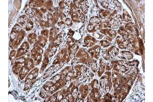 IHC-P Image CRHSP-24 antibody [N1C3] detects CRHSP-24 protein at cytoplasm in mouse prostate by immunohistochemical analysis. (CARHSP1 antibody)