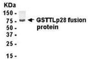 Western Blotting (WB) image for anti-Glutathione S-Transferase omega 1 (GSTO1) (AA 1-241) antibody (ABIN2468060) (GSTO1 antibody  (AA 1-241))