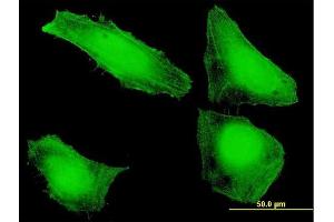 Immunofluorescence of purified MaxPab antibody to SLIC1 on HeLa cell.