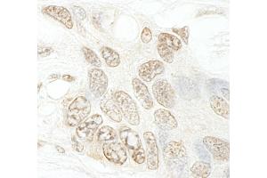 Immunohistochemistry (IHC) image for anti-SET Domain Containing 1B (SETD1B) (AA 350-400) antibody (ABIN7448602) (SETD1B antibody  (AA 350-400))