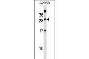 Western blot analysis in A2058 cell line lysates (35ug/lane). (PLA2G12A antibody  (AA 55-83))
