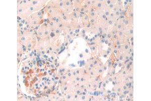 Used in DAB staining on fromalin fixed paraffin- embedded Kidney tissue (ANGPTL4 antibody  (AA 228-389))