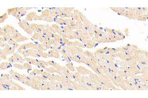 Detection of LTA4H in Mouse Cardiac Muscle Tissue using Polyclonal Antibody to Leukotriene A4 Hydrolase (LTA4H) (LTA4H antibody  (AA 135-272))