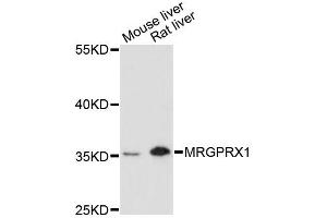 Western blot analysis of extracts of various cell lines, using MRGPRX1 antibody (ABIN6293323) at 1:3000 dilution. (MRGPRX1 antibody)