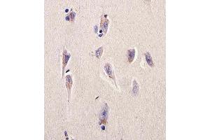 Immunohistochemical analysis of paraffin-embedded H. (Dihydrofolate Reductase antibody  (N-Term))