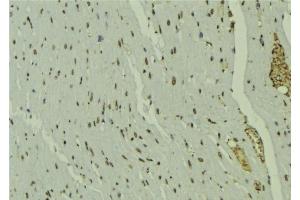ABIN6277684 at 1/100 staining Mouse muscle tissue by IHC-P. (PPARD antibody  (C-Term))