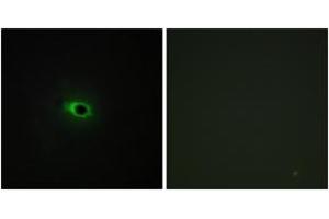 Immunofluorescence analysis of COS7 cells, using Collagen XII alpha1 Antibody. (COL12A1 antibody  (AA 1481-1530))