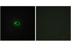 Immunofluorescence analysis of COS7 cells, using Collagen XII alpha1 Antibody.