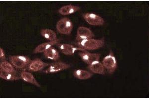 Immunofluorescence staining of HeLa cells (Human cervical epitheloid carcinoma, ATCC CCL-2. (TRADD antibody  (AA 163-312))