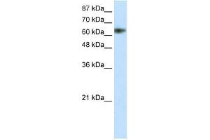 Transfected 293T; WB Suggested Anti-ZNF447 Antibody Titration: 1.