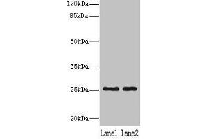 Western blot All lanes: NDFIP1 antibody at 8 μg/mL Lane 1: 293T whole cell lysate Lane 2: Hela whole cell lysate Secondary Goat polyclonal to rabbit IgG at 1/10000 dilution Predicted band size: 25, 17 kDa Observed band size: 25 kDa (NDFIP1 antibody  (AA 2-116))