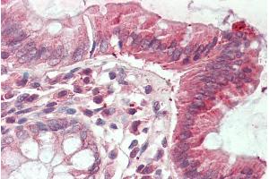 ABIN1781990 (5µg/ml) staining of paraffin embedded Human Colon. (CLIC1 antibody  (Internal Region))