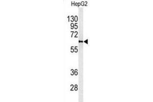 Western Blotting (WB) image for anti-Phospholipid Transfer Protein (PLTP) antibody (ABIN3003343) (PLTP antibody)