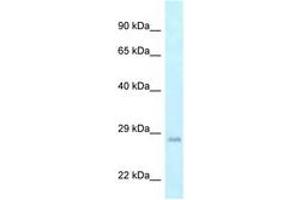 GADD45GIP1 antibody  (AA 102-151)