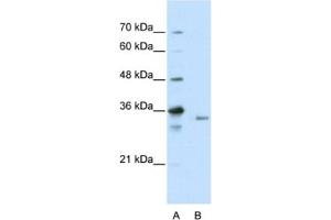 Western Blotting (WB) image for anti-Exosome Component 3 (EXOSC3) antibody (ABIN2462262) (EXOSC3 antibody)