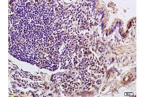 Formalin-fixed and paraffin embedded rat colon labeled with Anti- LONP1 Polyclonal Antibody, Unconjugated (ABIN705806) at 1:200 followed by conjugation to the secondary antibody Goat Anti-Rabbit IgG, Cy3 conjugated used at 1:200 dilution for 40 minutes at 37°C (LONP1 antibody  (AA 361-460))