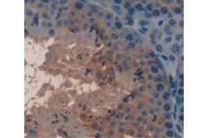 Figure. (COMP antibody  (AA 317-455))