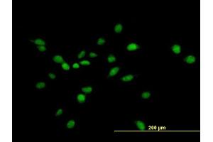 Immunofluorescence of purified MaxPab antibody to NUAK1 on HeLa cell. (NUAK1 antibody  (AA 1-661))