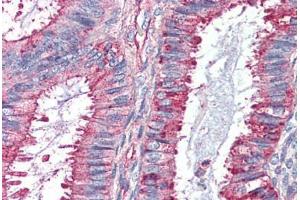 Human Uterus (formalin-fixed, paraffin-embedded) stained with GPR27 antibody ABIN410770 followed by biotinylated goat anti-rabbit IgG secondary antibody ABIN481713, alkaline phosphatase-streptavidin and chromogen. (GPR27 antibody  (Internal Region))