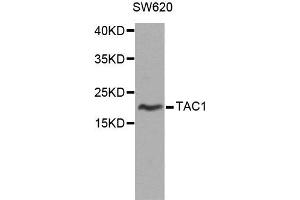 Western blot analysis of extracts of SW620 cells, using TAC1 antibody. (TAC1 antibody)