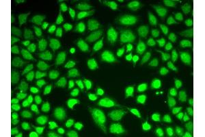 Immunofluorescence analysis of A549 cells using KDM1A antibody. (LSD1 antibody)