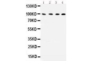 Observed bind size: 100KD (ICAM1 antibody  (AA 28-480))
