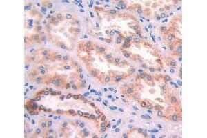 Used in DAB staining on fromalin fixed paraffin- embedded Kidney tissue (APOA4 antibody  (AA 173-396))