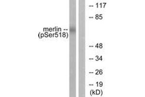 Western blot analysis of extracts from HuvEc cells treated with IFN-alpha 1000U/ml 18h, using Merlin (Phospho-Ser518) Antibody. (Merlin antibody  (pSer518))