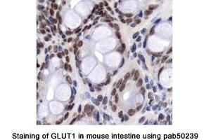 Image no. 1 for anti-Solute Carrier Family 2 (Facilitated Glucose Transporter), Member 1 (SLC2A1) (AA 1-100), (N-Term) antibody (ABIN363548) (GLUT1 antibody  (N-Term))