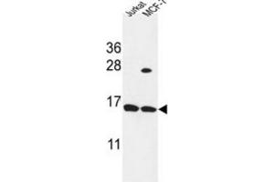 Western Blotting (WB) image for anti-Small Proline Rich Protein 1A (SPRR1A) antibody (ABIN3004230)