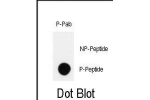 Dot blot analysis of anti-Phospho-HIPK2-p Antibody (ABIN389999 and ABIN2839776) on nitrocellulose membrane. (HIPK2 antibody  (pTyr361))