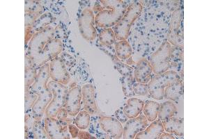 Used in DAB staining on fromalin fixed paraffin- embedded kidney tissue (Plakophilin 1 antibody  (AA 500-742))