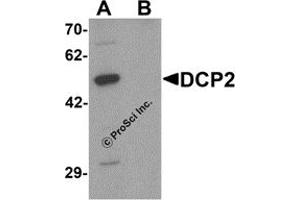 Western Blotting (WB) image for anti-DCP2 Decapping Enzyme Homolog (DCP2) (C-Term) antibody (ABIN1077379) (DCP2 antibody  (C-Term))