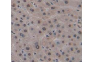 Used in DAB staining on fromalin fixed paraffin- embedded Kidney tissue (DP1 antibody  (AA 6-410))