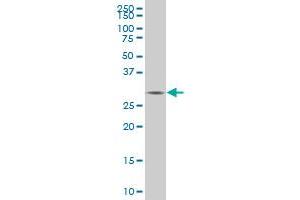 TGIF2 monoclonal antibody (M06), clone 6A8 Western Blot analysis of TGIF2 expression in IMR-32 . (TGIF2 antibody  (AA 131-236))