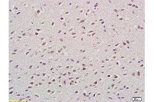 Formalin-fixed and paraffin embedded rat brain labeled with Anti-SEMA4A Polyclonal Antibody, Unconjugated (ABIN873193) at 1:200 followed by conjugation to the secondary antibody and DAB staining. (Sema4a antibody  (AA 361-460))