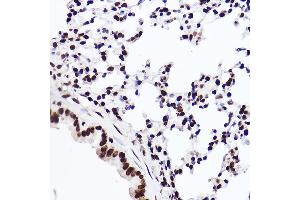 Immunohistochemistry of paraffin-embedded mouse lung using MonoMethyl-Histone H3-K18 Rabbit mAb (ABIN7267683) at dilution of 1:100 (40x lens). (Histone 3 antibody  (H3K18me))