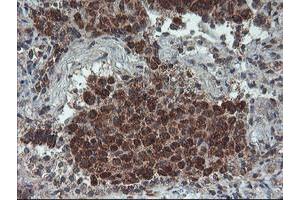 Image no. 1 for anti-Protein Phosphatase 1, Regulatory (Inhibitor) Subunit 15A (PPP1R15A) antibody (ABIN1498363)