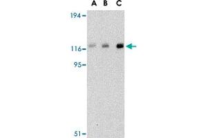 Western blot analysis of CBL in Daudi cell lysate with CBL polyclonal antibody  at (A) 0. (CBL antibody  (C-Term))