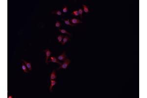 ABIN6266833 staining HeLa  cells by IF/ICC. (ARMCX3 antibody  (N-Term))
