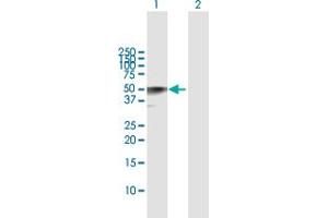 Western Blot analysis of CALR3 expression in transfected 293T cell line by CALR3 MaxPab polyclonal antibody. (Calreticulin 3 antibody  (AA 1-384))