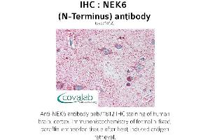 Image no. 1 for anti-NIMA (Never in Mitosis Gene A)-Related Kinase 6 (NEK6) (N-Term) antibody (ABIN1737252) (NEK6 antibody  (N-Term))