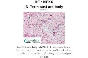 Image no. 1 for anti-NIMA (Never in Mitosis Gene A)-Related Kinase 6 (NEK6) (N-Term) antibody (ABIN1737252)