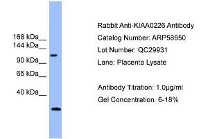 WB Suggested Anti-KIAA0226  Antibody Titration: 0.