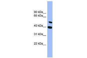 SMU1 antibody used at 1 ug/ml to detect target protein. (SMU1 antibody)