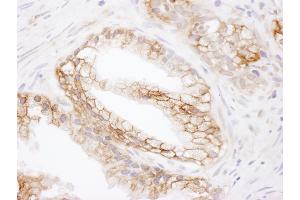 anti-Solute Carrier Family 16, Member 1 (Monocarboxylic Acid Transporter 1) (SLC16A1) (AA 450-500) antibody