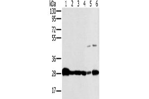 Western Blotting (WB) image for anti-NADH Dehydrogenase (Ubiquinone) Fe-S Protein 3, 30kDa (NADH-Coenzyme Q Reductase) (NDUFS3) antibody (ABIN2423863) (NDUFS3 antibody)