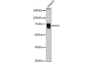 Western blot analysis of extracts of HepG2 cells, using NF2 Rabbit pAb (ABIN6128276, ABIN6144549, ABIN6144552 and ABIN6217696) at 1:1000 dilution. (Merlin antibody  (AA 477-576))